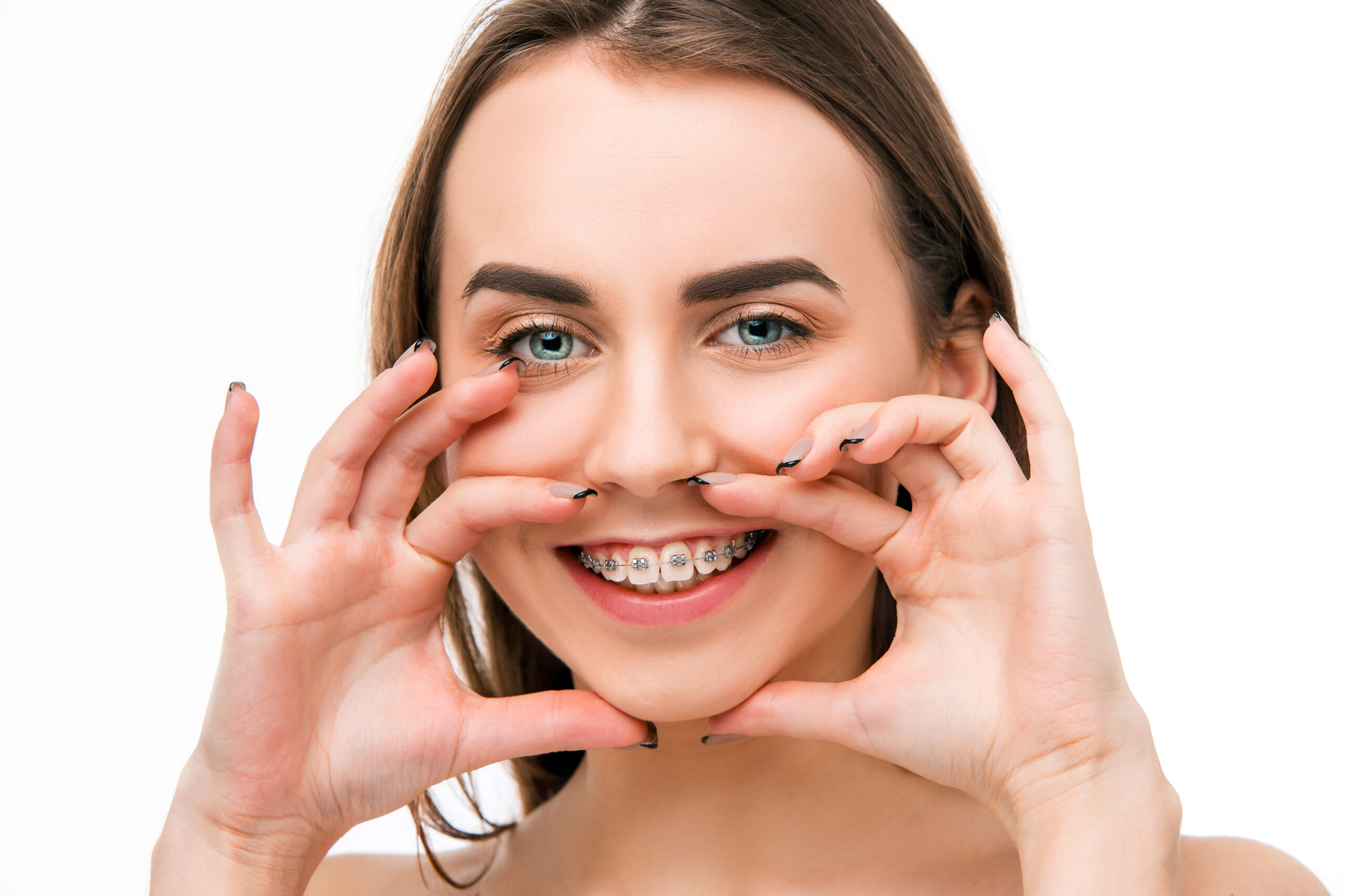 Orthodontics In Hyderabad