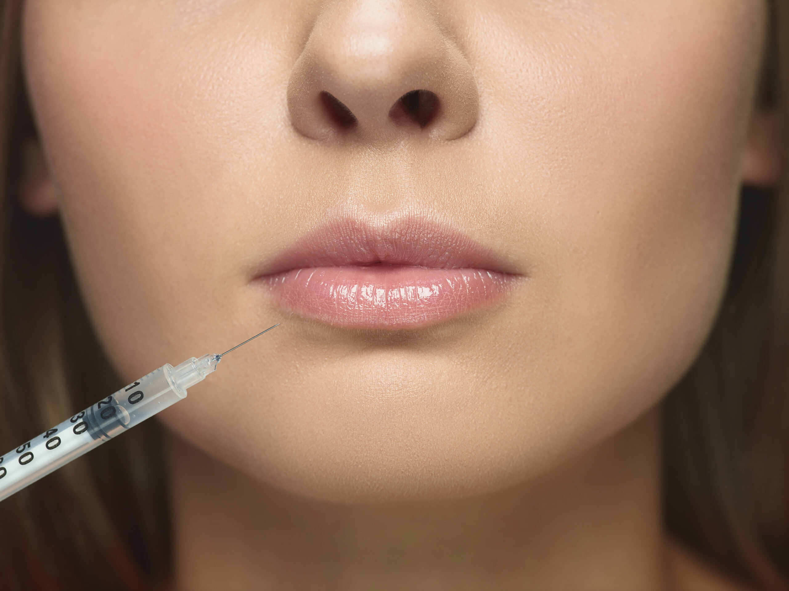 Lip Lengthening Treatment in Hyderabad